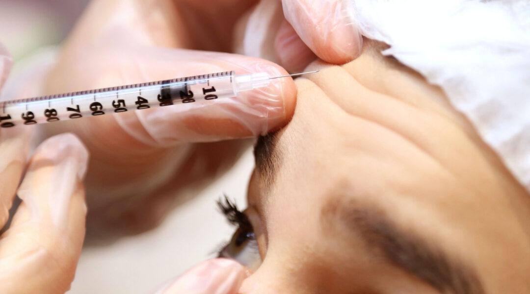 “Botox: Your Guide to Wrinkle Prevention and What You Should Know”